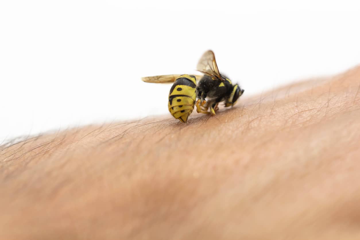 Bee Sting