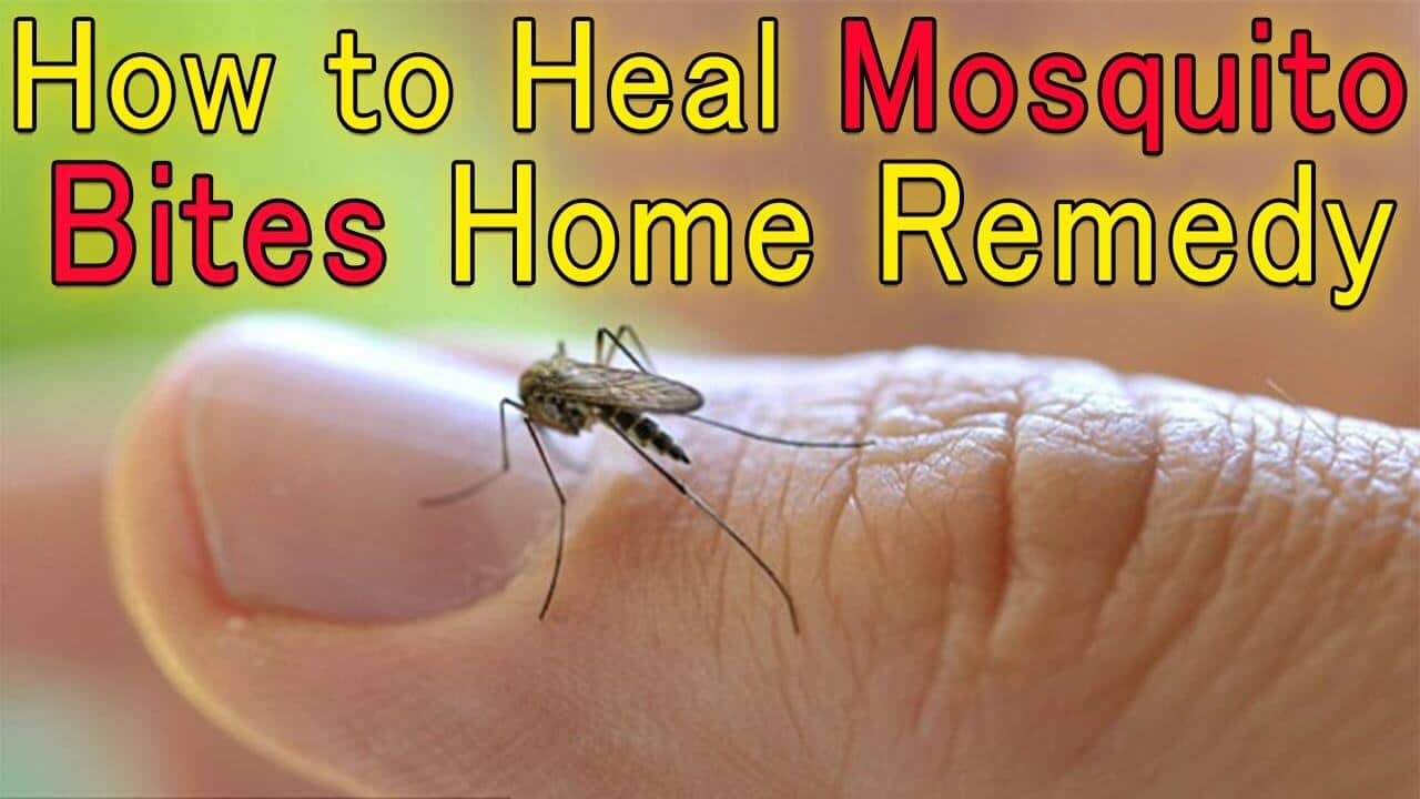 mosquito bites