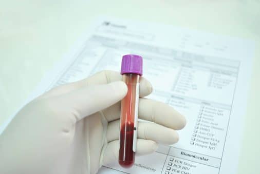 allergy blood test