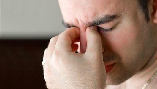 allergic rhinitis