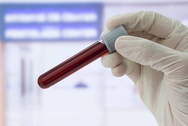 blood sample