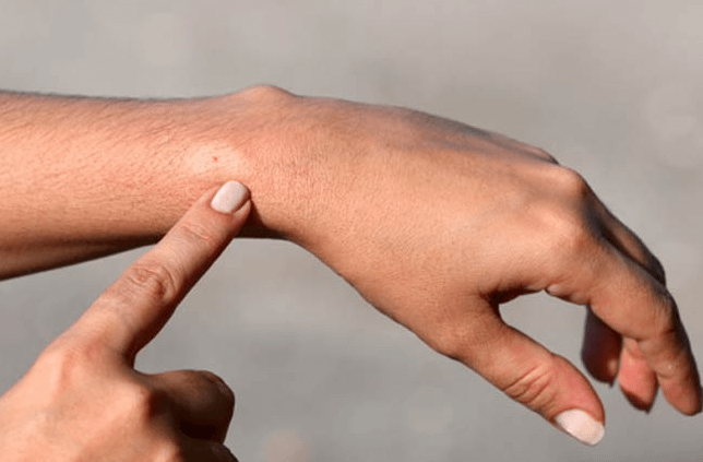 skin-allergies