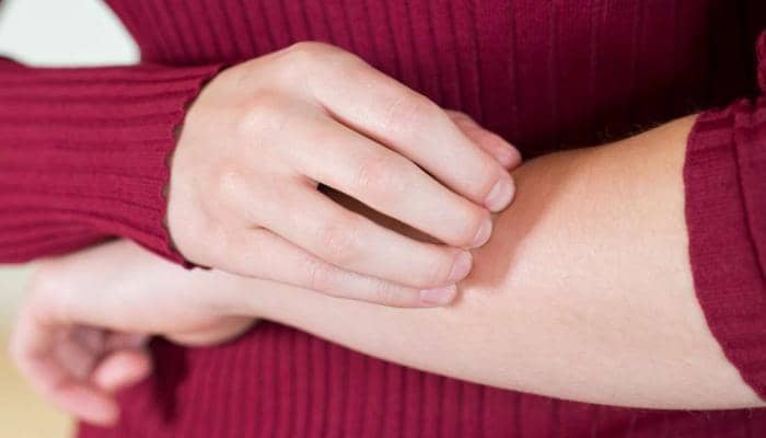 7 Causes of Itchy and Red Skin: Most Notably Diabetes and Allergies