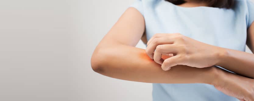 Get Rid of Skin Allergy